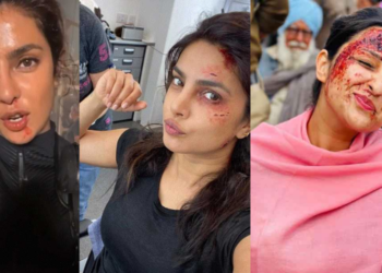 Priyanka Chopra के बाद अब परिणीति चोपड़ा ने शेयर की खून से लथपथ तस्वीरें!