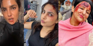 Priyanka Chopra के बाद अब परिणीति चोपड़ा ने शेयर की खून से लथपथ तस्वीरें!