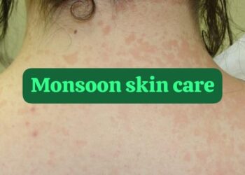 Protect skin from infections during monsoon