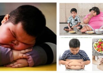 Childhood obesity causes prevention and health impact