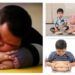 Childhood obesity causes prevention and health impact