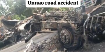 Unnao Road Accident: DUMPER और DCM की आमने-सामने भिड़ंत, गाडियां हुई जल कर खाक तीन लोगों की दर्दनाक मौत