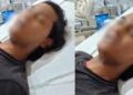 लड़के ने लड़की बनने के लिए काटा अपना प्राईवेट पार्ट, कौन है ‘वो’ जिसके कहने पर खुद का किया ऑपरेशन
