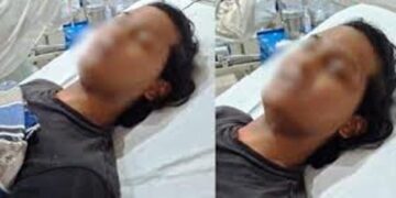 लड़के ने लड़की बनने के लिए काटा अपना प्राईवेट पार्ट, कौन है ‘वो’ जिसके कहने पर खुद का किया ऑपरेशन