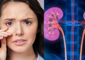 Signs of Kidney Problems: क्या है किडनी खराब होने के शुरुआती संकेत, कौन से लक्षण आंखों में दिखे तो हो जाएं होशियार