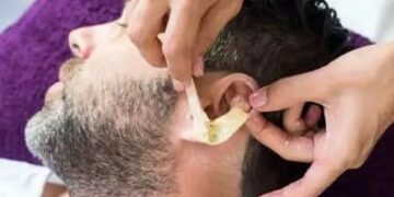 Ear hair good luck sign New