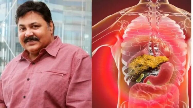 Satish Shah kidney failure causes symptoms treatment