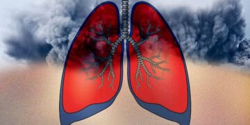 प्रदूषित हवा फेफड़ों पर कैसे हमला करती है? बचने का क्या है उपाय?