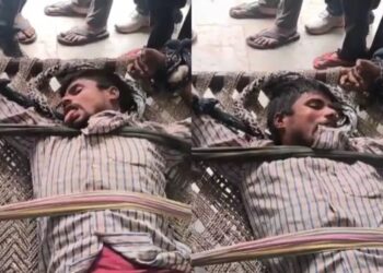 Aligarh Rabies Case:आवारा कुत्ते के काटने के बाद युवक में दिखे अजीब लक्षण, गांव में फैली दहशत वीडियो हुआ वायरल