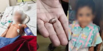 Lucknow: तीसरी मंजिल पर खेल रही मासूम को लगी अनजान जगह से चली गोली, डॉक्टरों ने समय रहते बचाई जान,