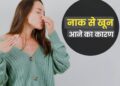 Summer Health: लू और गर्मी से क्यों बहने लगता है नाक से खून? जानें इसको रोकने का सही तरीका