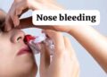 Nose Bleeding in Summer