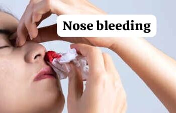 Nose Bleeding in Summer