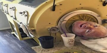 Paul Alexander Iron Lung Story