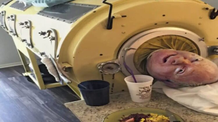Paul Alexander Iron Lung Story