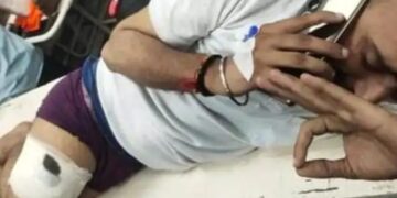Lucknow Shooting Case Youth Shot