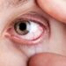 Digital Eye Strain : क्या मोबाइल और लैपटॉप स्क्रीन की आदत बन रही है आंखों की दुश्मन, कौन से संकेत हैं गंभीर