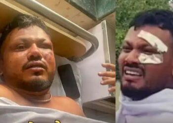 Ahmedabad Plane Crash: छलका दर्द, बताया हादसे के बाद का संघर्ष, मौत को छुकर लौटे यात्री की दर्दभरी कहानी
