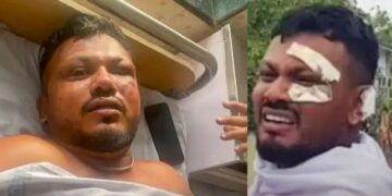 Ahmedabad Plane Crash: छलका दर्द, बताया हादसे के बाद का संघर्ष, मौत को छुकर लौटे यात्री की दर्दभरी कहानी