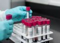 Blood Test for Cancer : भारत पहुंची नई जांच तकनीक, एक ब्लड टेस्ट से 10 तरह के कैंसर की होगी पहचान