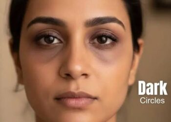 Dark Circles: क्या आंखों के नीचे काले घेरे दिल की बीमारी का संकेत हैं? जानिए क्या कहते हैं एक्सपर्ट