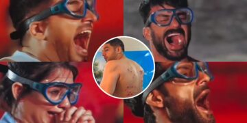 Khatron Ke Khiladi 15: खतरनाक स्टंट के बाद घायल हुए Gaurav Khanna, फैंस ने जताई चिंता