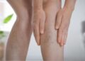 Blue Veins on Legs