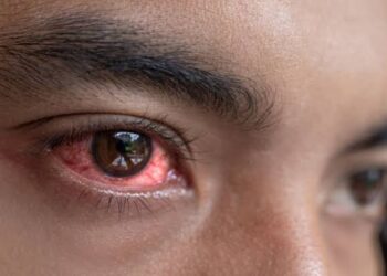 Monsoon Eye Care: बारिश में तेजी से फैलता है Pink Eye इन्फेक्शन,जानें इससे बचने के आसान उपाय