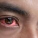 Monsoon Eye Care: बारिश में तेजी से फैलता है Pink Eye इन्फेक्शन,जानें इससे बचने के आसान उपाय