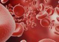 Hemoglobin Level: क्या हीमोग्लोबिन का ज़्यादा होना भी है चिंता की बात? जाने किन बिमारियों को मिल सकता है बढ़ावा