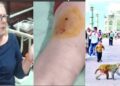 Monkey attack: Taj Mahal घूमने आई विदेशी महिला को बंदर ने काटा,6 साल का बच्चा भी घायल