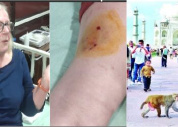 Monkey attack: Taj Mahal घूमने आई विदेशी महिला को बंदर ने काटा,6 साल का बच्चा भी घायल