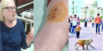 Monkey attack: Taj Mahal घूमने आई विदेशी महिला को बंदर ने काटा,6 साल का बच्चा भी घायल