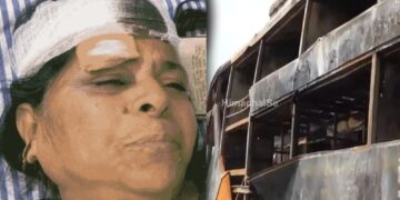 Bus Tragedy : महोबा जा रही स्लीपर बस में लगी थी आग, महिला ने बताया वह कैसे बची, क्यों नहीं बच पाया उसका पति